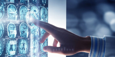 BC Platforms Announces Collaborations to Advance Research in Multiple Sclerosis
