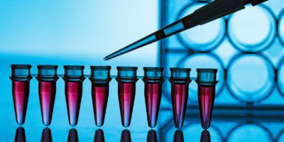 The advantages of prospective collection for modern biobanks