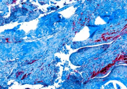 Transforming Oncology through Real-World Data